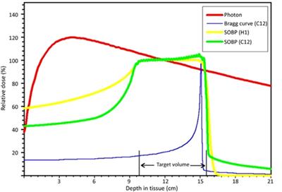 Particle radiotherapy for breast cancer